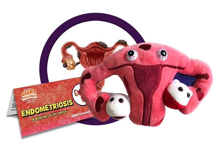 Endometriosis plush cluster