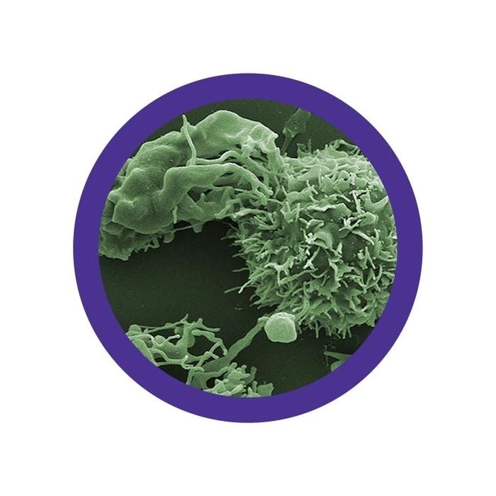 Lymphoma microbial