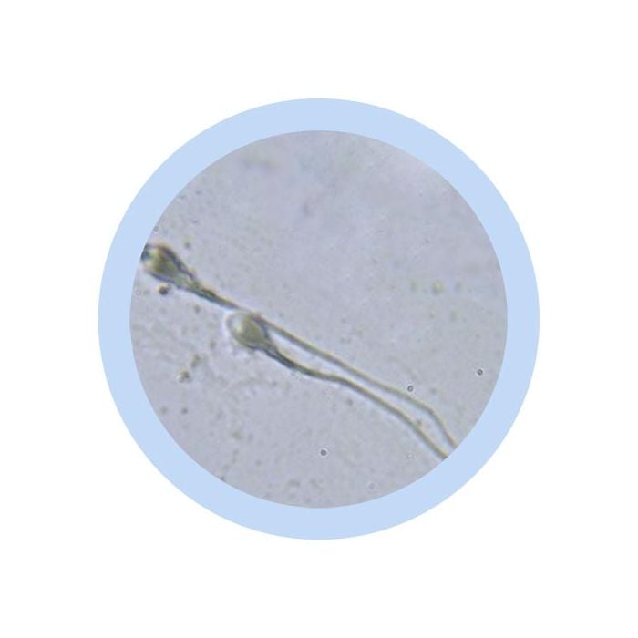 Sperm Cell microbial
