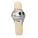 Knee Replacement plush angle