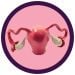 Uterus model image