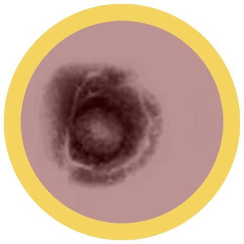 %s under a microscope!