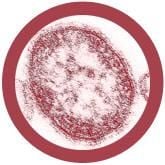 %s under a microscope!