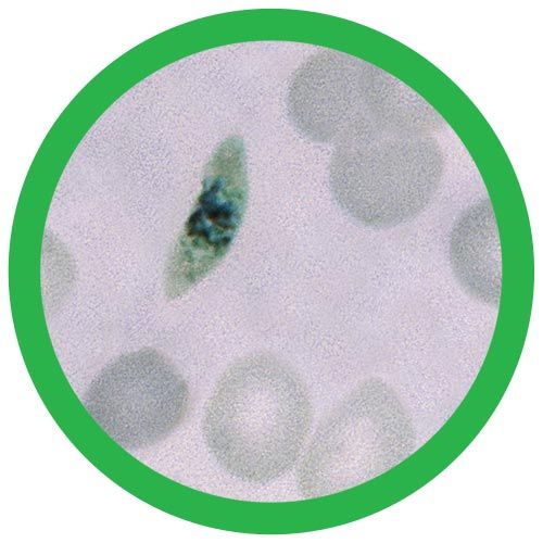 Malaria microbial