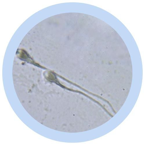 Sperm Cell microbial