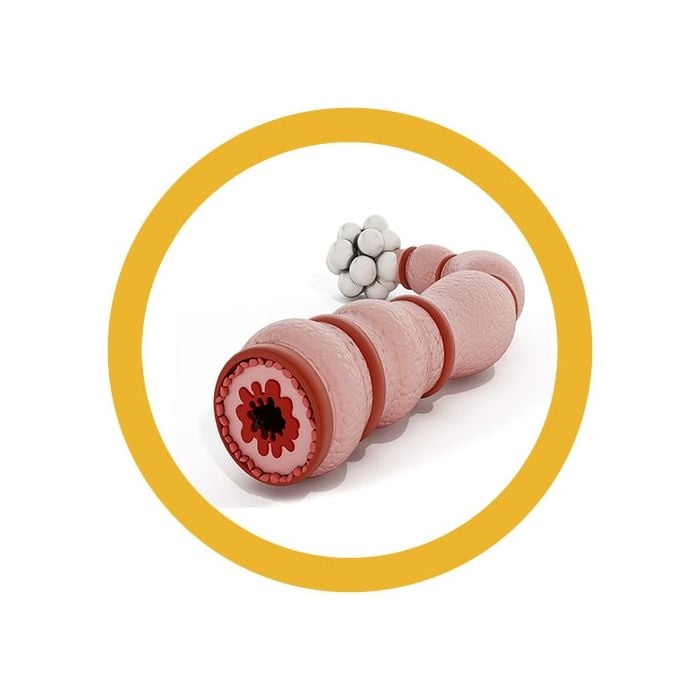 Asthma real image