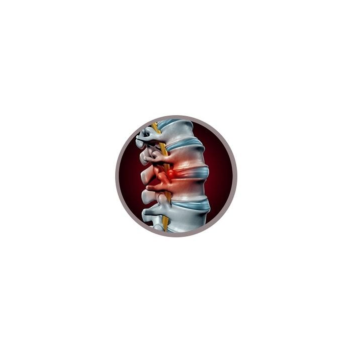 Back Pain real image