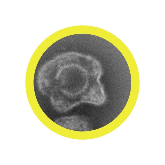 Herpes microbial
