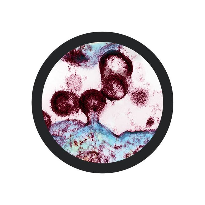 HIV microbial