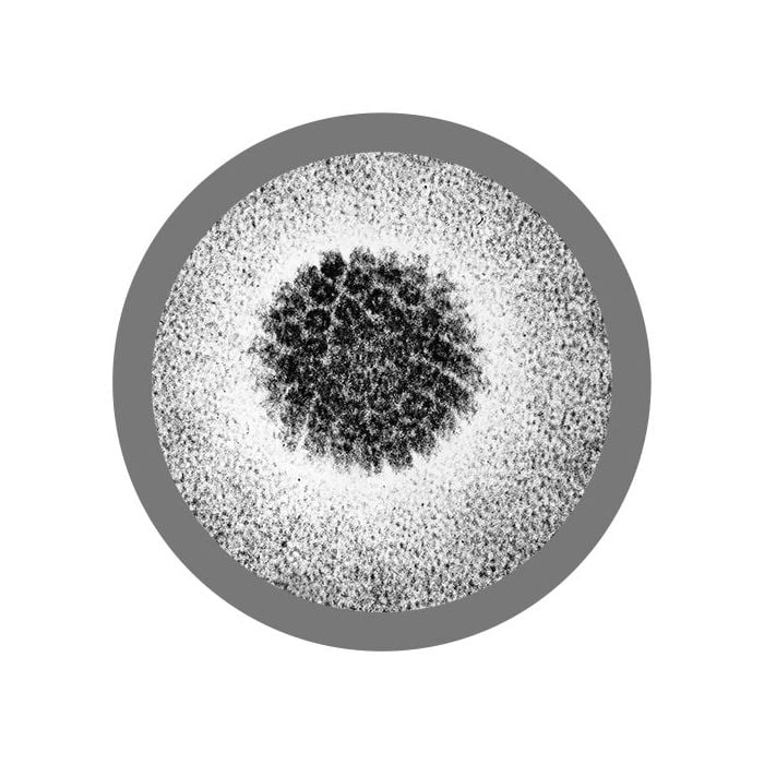 HPV real image