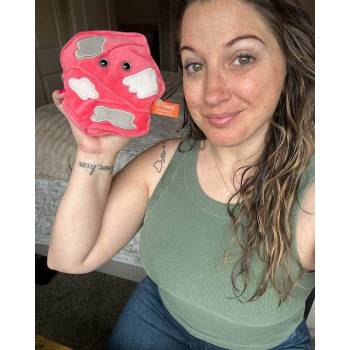 Psoriasis with ambassador Jen