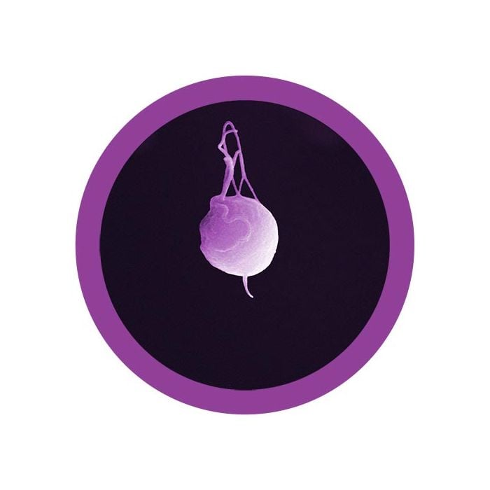 Trichomoniasis microbial