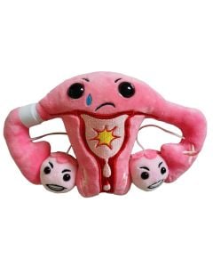 PMS Uterus