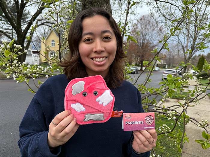 Model with Psoriasis plush