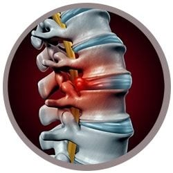 Back Pain real image