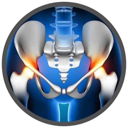 Hip Replacement Hip Surgery Post-OP Gift idea Throw Pillow Cover 18” x 18”