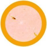 Leishmania microbial