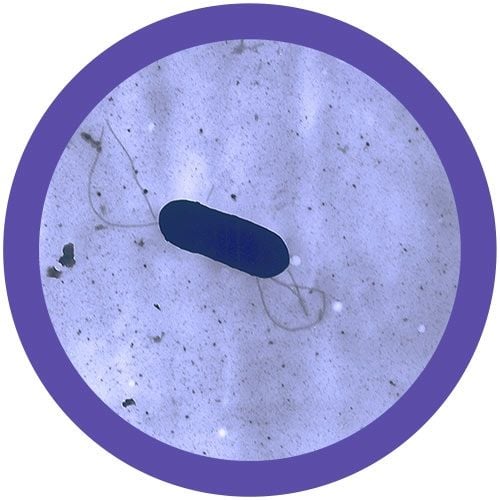 Listeria monocytogenes