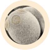 giant microbes yeast