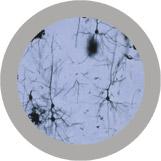giant microbes neuron