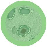 giant microbes gangrene