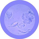 giant microbes giardia