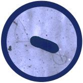 giant microbes listeria