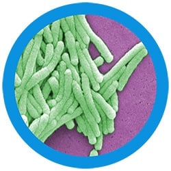 giant microbes pneumonia